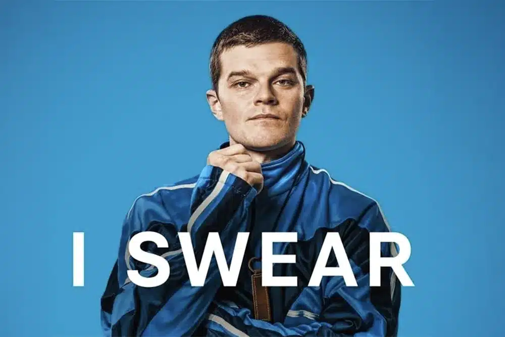 I Swear Robert Aramayo